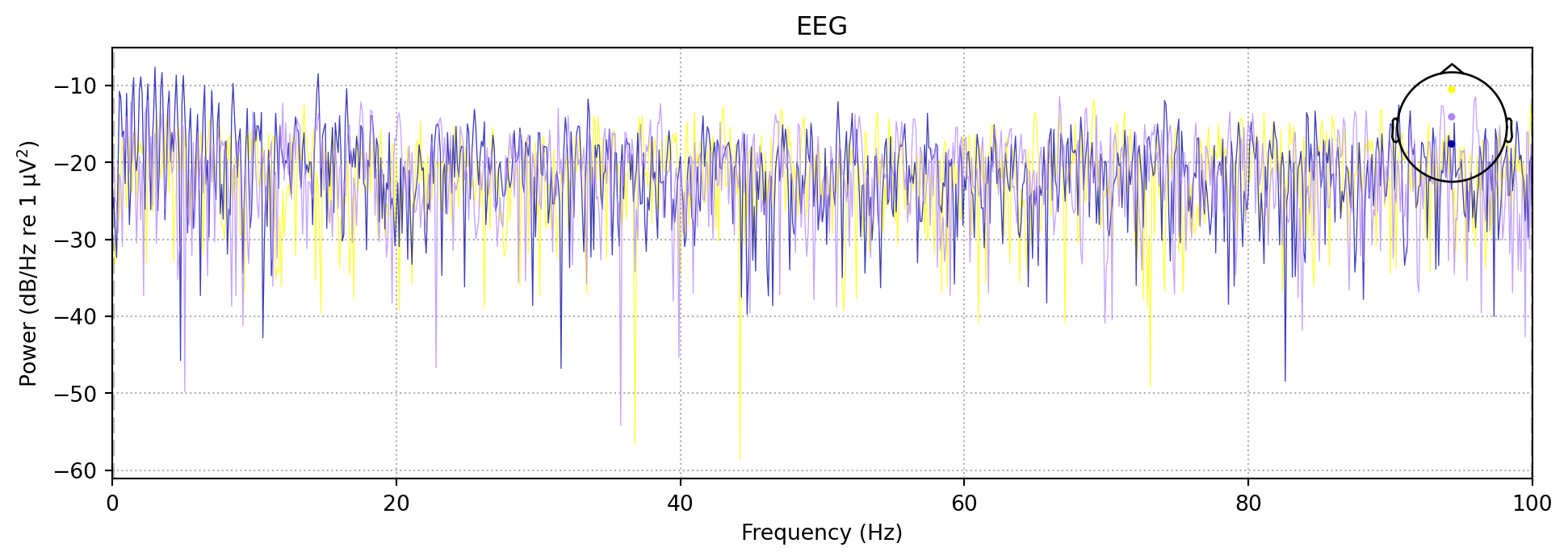 EEG preprocessing for ERP BCI paradigm with MNE-Python – aBCI OSS Example